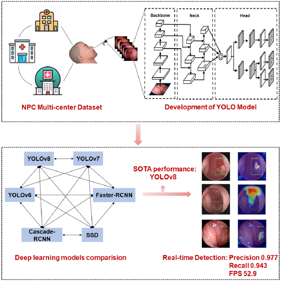 老虎机app
李健教授团队一项鼻咽癌人工智能识别研究成果在《iScience》上发表