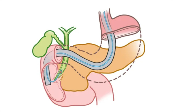 640_副本.jpg 640_副本.jpg